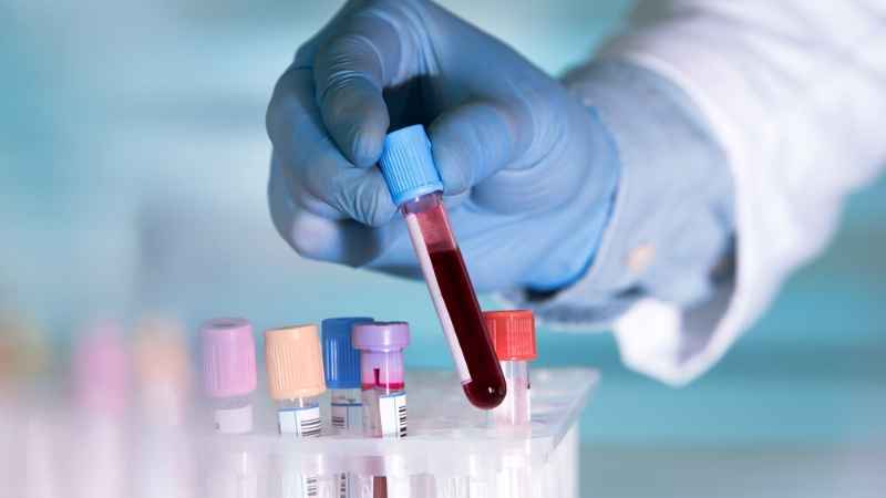Laboratorio de Análisis Clínicos en Talavera